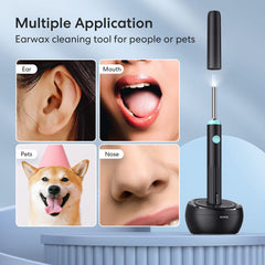 LENGIN ear camera connects to iPhone and Android for real-time viewing