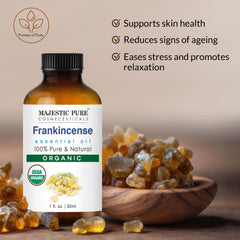 Majestic Pure Frankincense oil with dropper for controlled dosing in blends.
