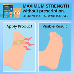 Meoly 40% salicylic acid targets warts and rough foot skin.