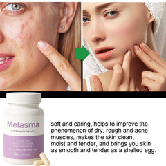 MILIZHIWU capsule closeup showing soft, easy to swallow pills for daily use