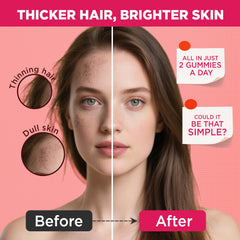 NATISLAND bites enriched with Biotin and zinc support nails and skin