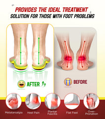 NEUPU plantar fasciitis insoles side profile showing high arch support