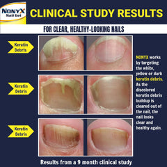 NONYX fungal nail clarifying gel drops show controlled dispensing for targeted care.