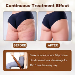 NXCYLW detachable-handle design for portable self-massage on the go.