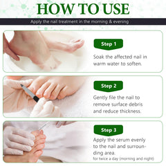 OMZOK cuticle nourishing treatment hydrates skin around nails for healthier look.