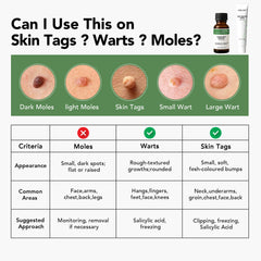 Ourui One Wart Remover kit instructions for safe at-home use