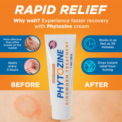 PHYTOZINE foot-care relief cream ready for on-the-go use.