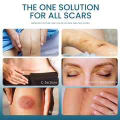 Close-up of Pinnoocy scar gel texture for smooth glide