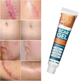 Pinnoocy scar gel bottle with pump for easy application