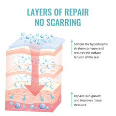 Pinnoocy scar gel on a healed scar area after surgery