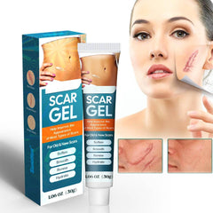 Pinnoocy scar gel being applied on scar area to moisturize