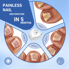 PUPCA nail fungus device timer settings for quick, personalized sessions