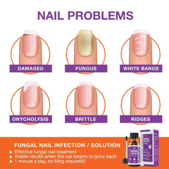 PureSkin nail file in use preparing the nail for treatment.
