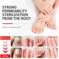 QQE Nail Fungus Treatment thin-layer application shown