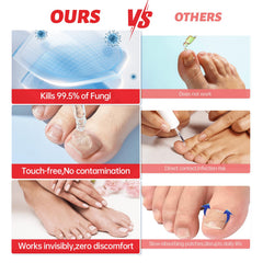 QQE Nail Fungus Treatment ingredients include aloe and tea tree