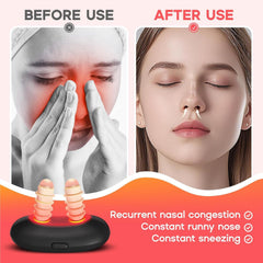 Red Light Therapy for Nose being cleaned with an alcohol wipe.