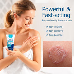 Roycederm applying cream on skin for easy daily relief