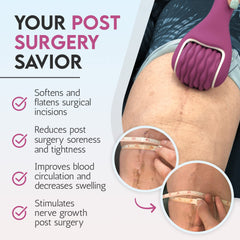 Scarroller vibration supports nerve sensation rebound during recovery.