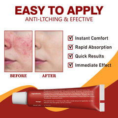 Seacall Hydrocortisone Cream box packaging for at-home use.