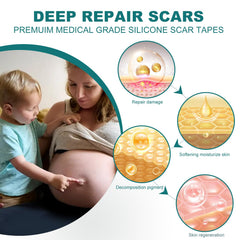 SLUKHIG pre-cut scar strips fit various scar sizes for flexible use.