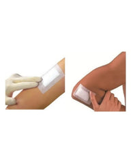 Smith & Nephew Primapore dressing box of 20 ready for sterile wound care.