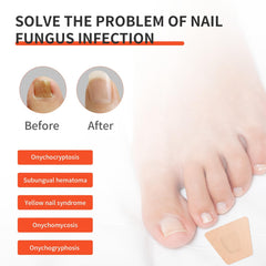 TMPETDENTAL extra-strength nail treatment patches deliver durable adhesion overnight