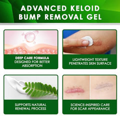 Tobcharm burn scar application on body demonstrates versatile use.