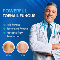 Tobcharm tea tree oil being applied to a toenail for antifungal care