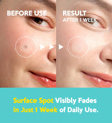 Troubless Micro Patch Plus Vitamin C 10% concentration for targeted spot care