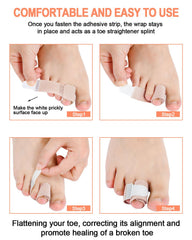 Uwbettry crooked toe aligner wrap demonstrates simple realignment support