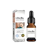 VivaBloom wart remover serum bottle for precise application on hands and feet, promoting smoother skin.
