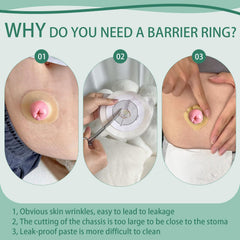 XIIFIIFII elastic moldable ring fits skin for comfortable wear