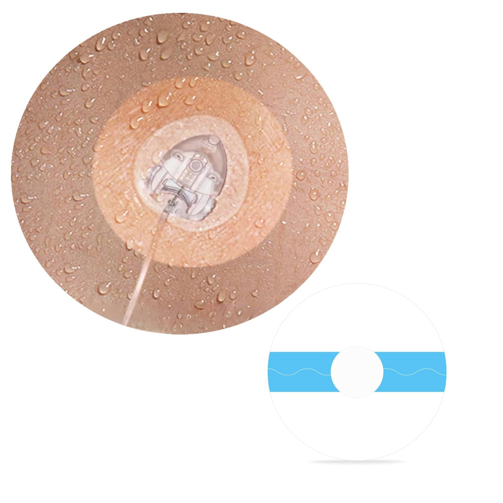 XILETIGOHA infusion patch compatibility for multiple CGMs and pumps.