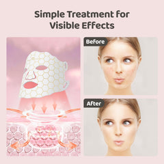 Yahi Red Light Mask remote control showing easy color and timer adjustments