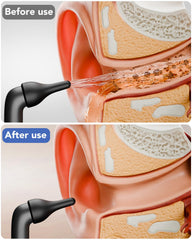 Yakbio ear cleaner with 3 modes control panel; customizable cleaning intensity.
