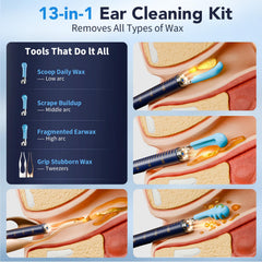Yakbio ear cleaner camera with LED lights illuminates the canal