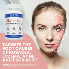 SkinVite capsules close-up showing texture and color for acne support