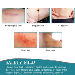 ZODENIS scar tape demonstrates pain-free removal with no residue.