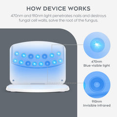 ZZP nail fungus light device switch on/off for easy operation