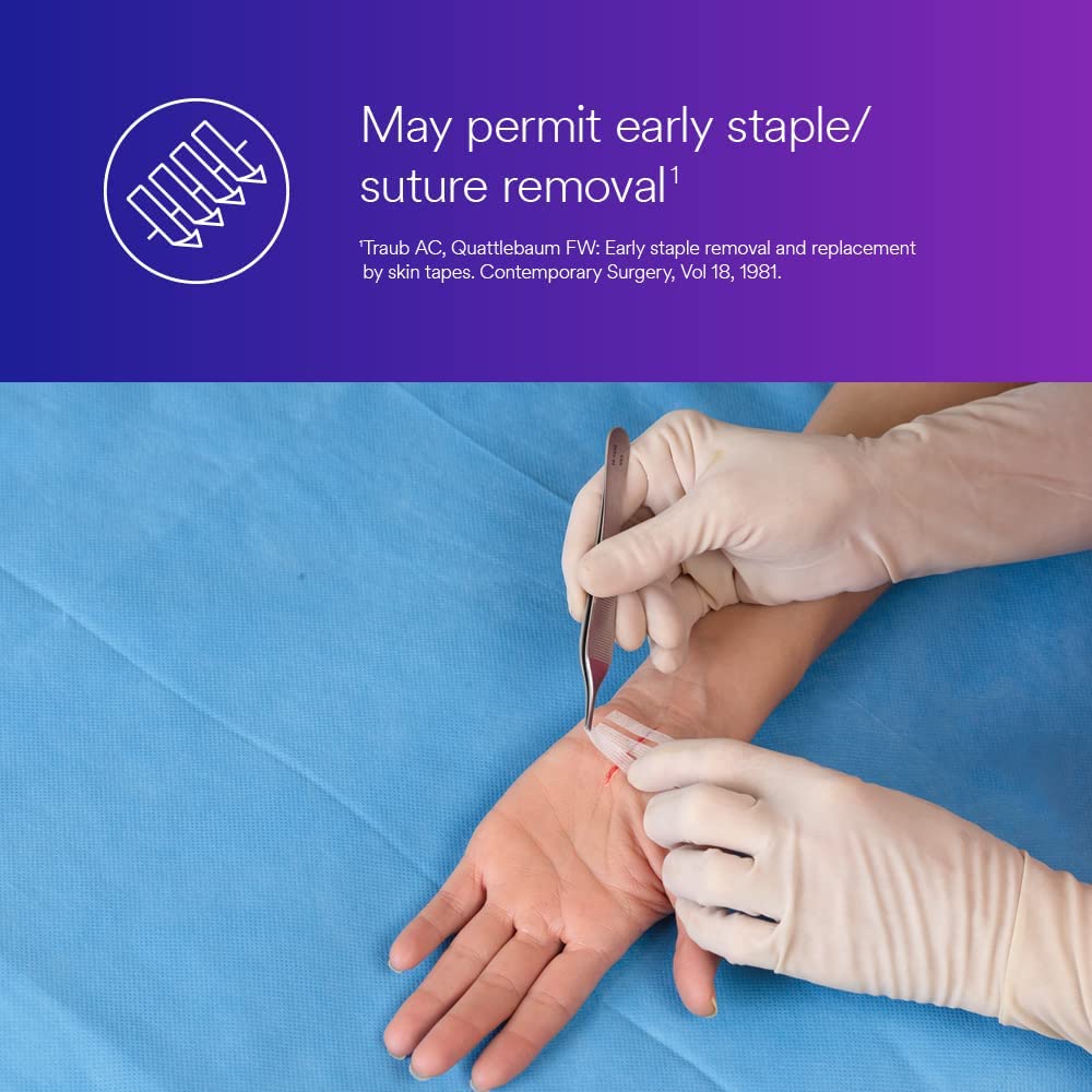 Application of 3M Steri-Strip on a minor skin laceration in clinical setting.