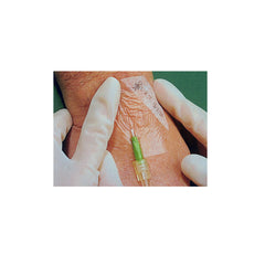 Picture-frame delivery enables precise placement of 3M Tegaderm frame-style dressing
