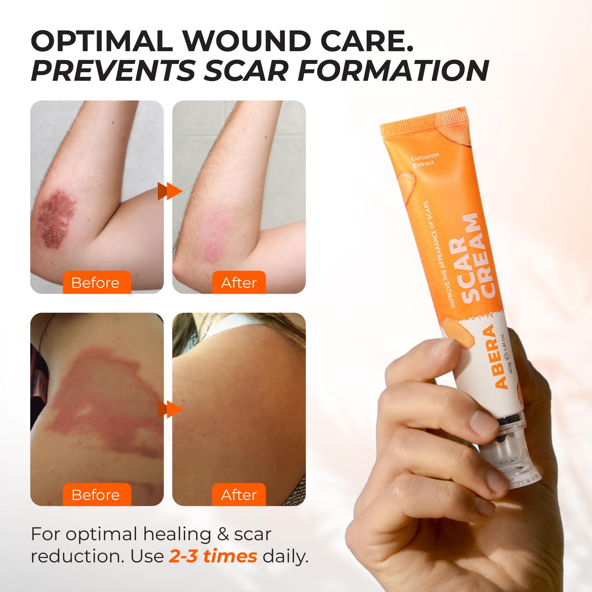 ABERA scar cream texture on skin shows smooth, non-greasy absorption.
