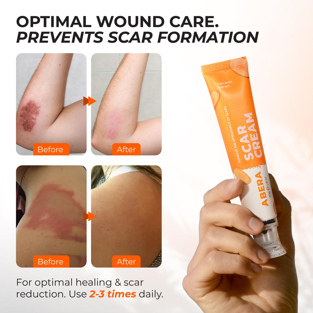 ABERA scar cream texture on skin shows smooth, non-greasy absorption.