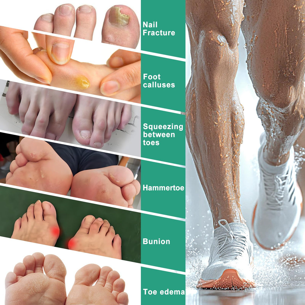 Aheroi corn protection sleeve cushions corns and prevents toe rubbing