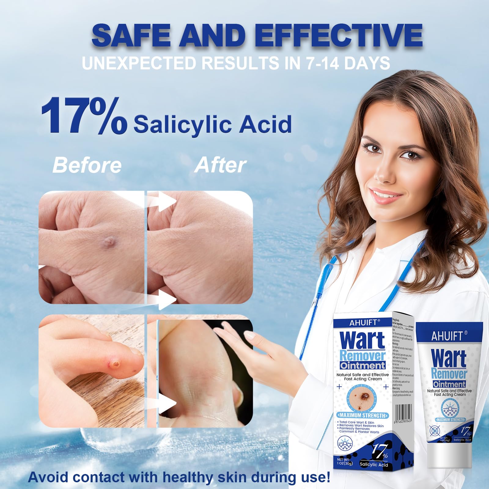 AHUIFT Wart Remover ointment tube shows easy, prescription-free application for fast relief.