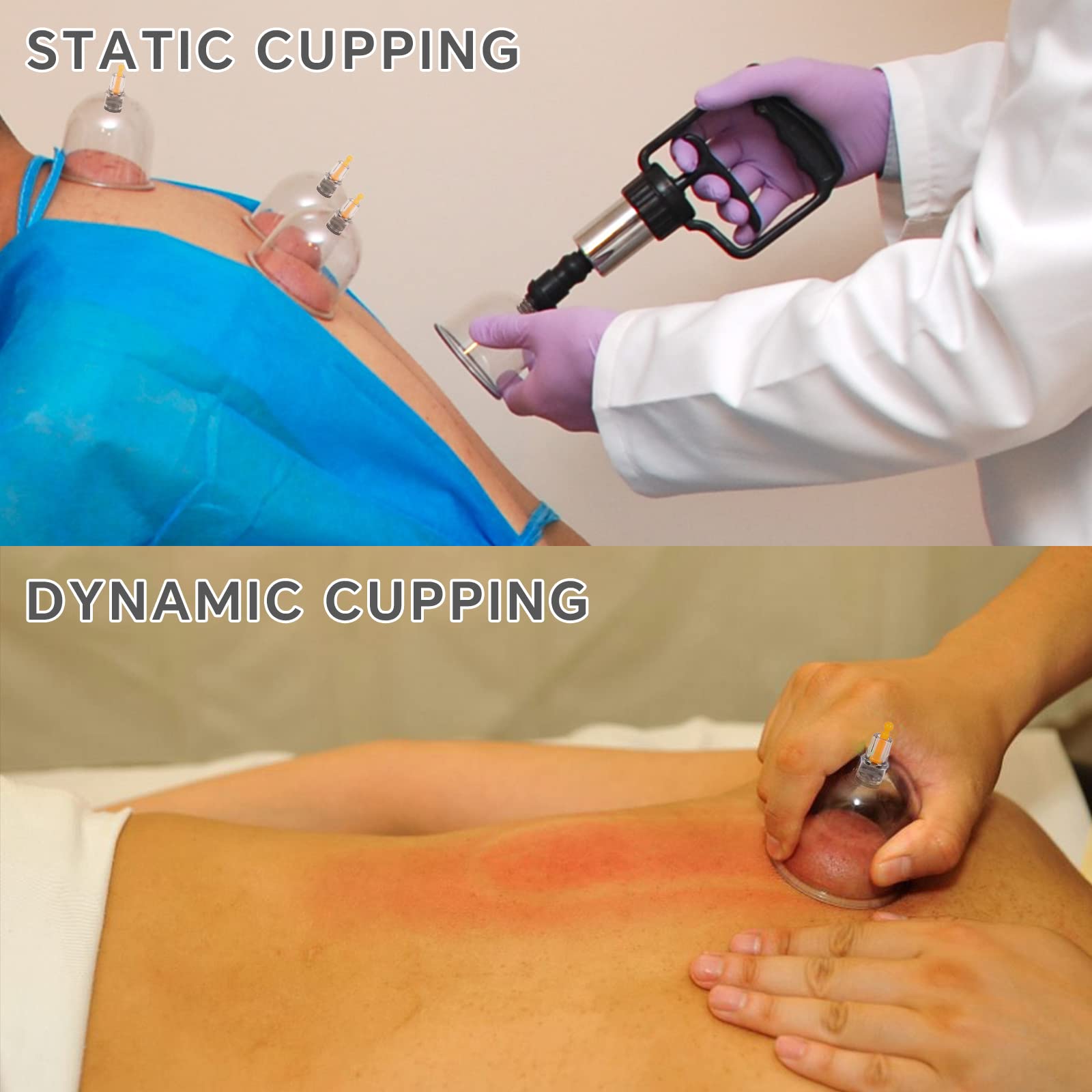 AIKOTOO cupping set includes Gua Sha tool for added self-care routines