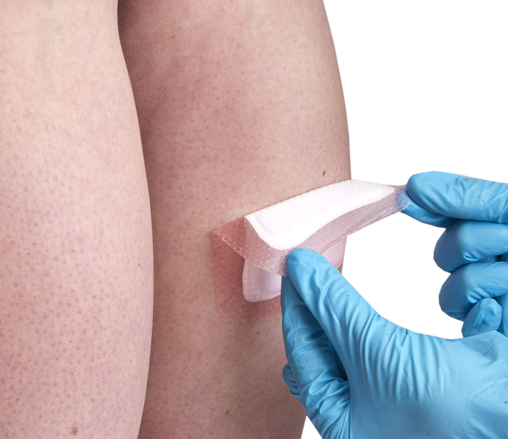 Allevyn Gentle Border dressing on skin demonstrates breathable wear and protection.