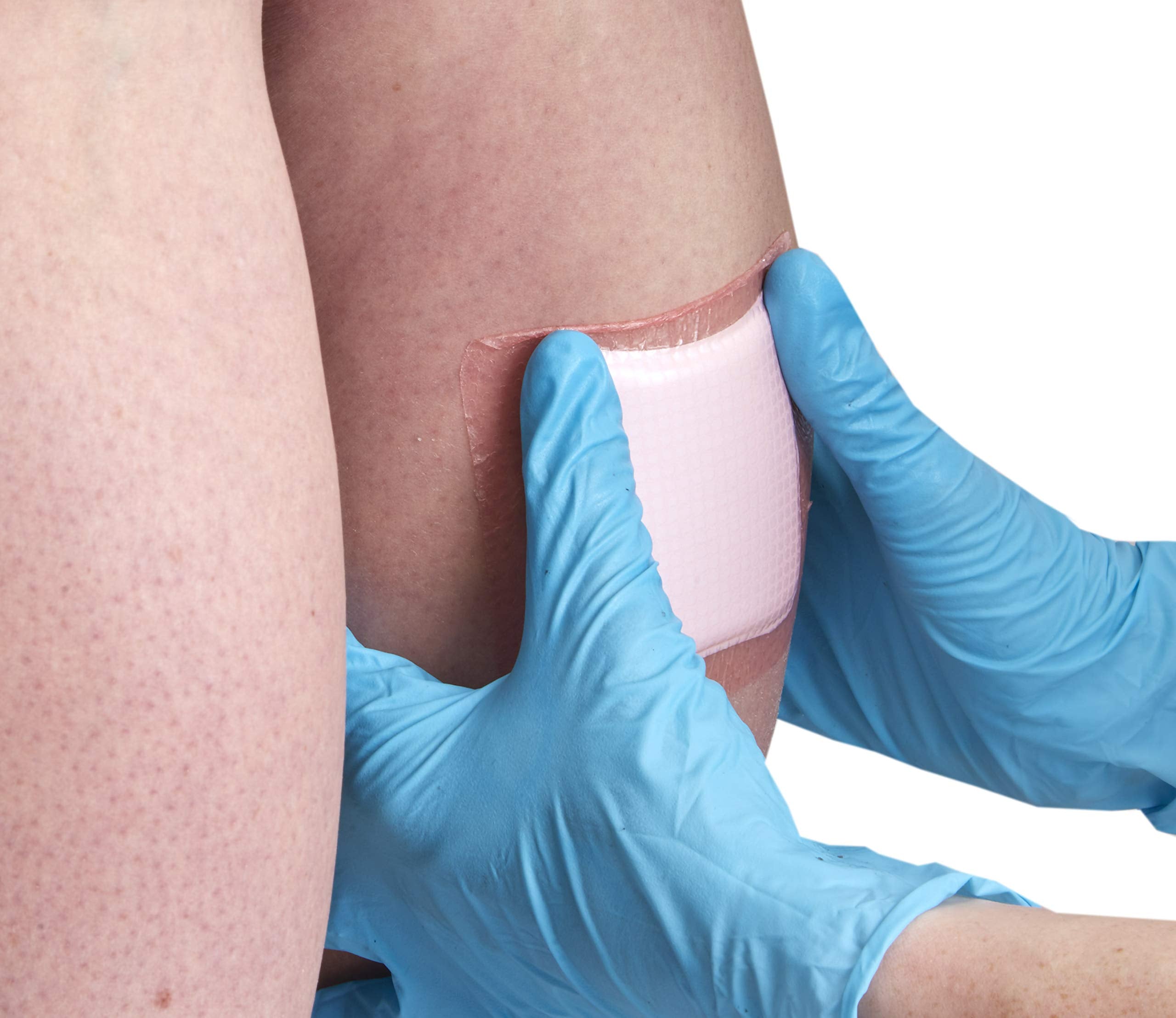 Allevyn Gentle Border on skin highlights gentle adhesion and secure fit.