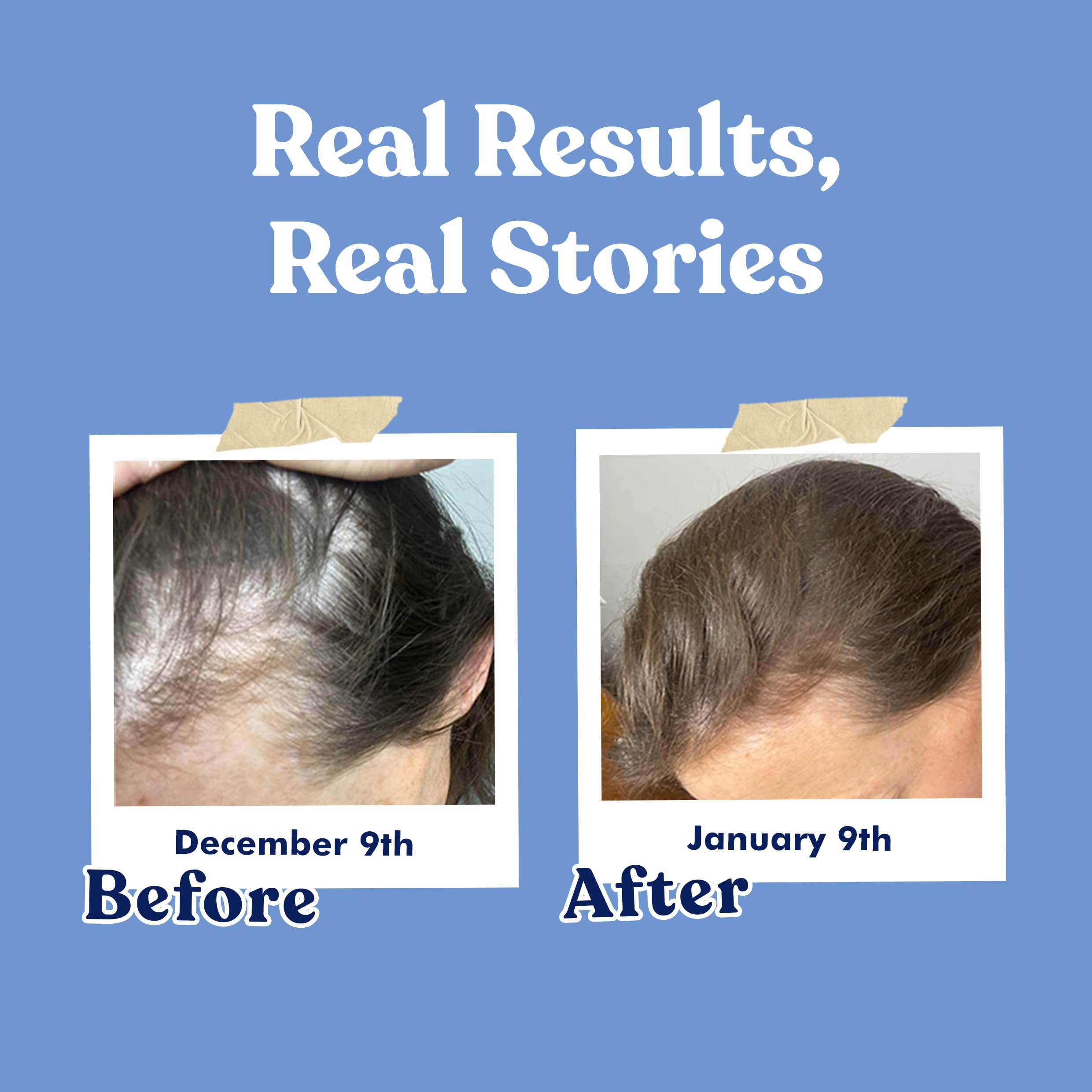 American Standard Biotin capsules closeup emphasizes capsule texture and premium quality