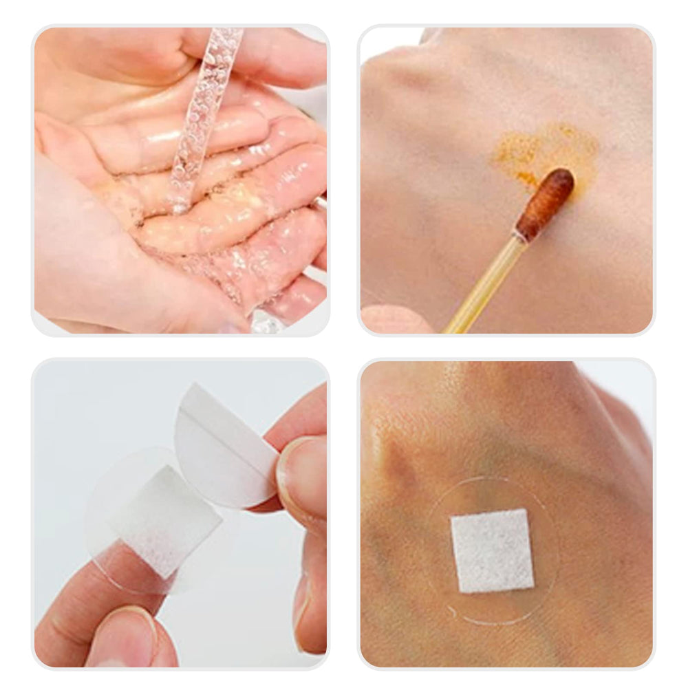 AndicAge easy-application bandage peels and sticks smoothly for quick wound coverage.
